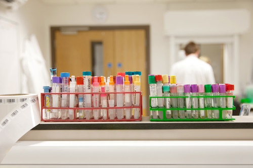 Research test tubes